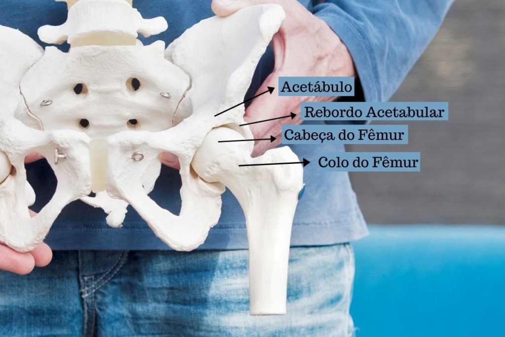 O que é IFA – Impacto Fêmoro Acetabular? - Dr. Vilson Damina - Cirurgia ...